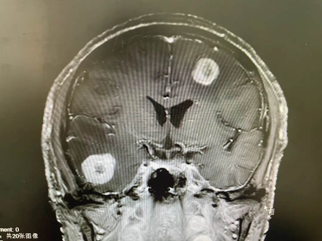 Preoperative Imaging