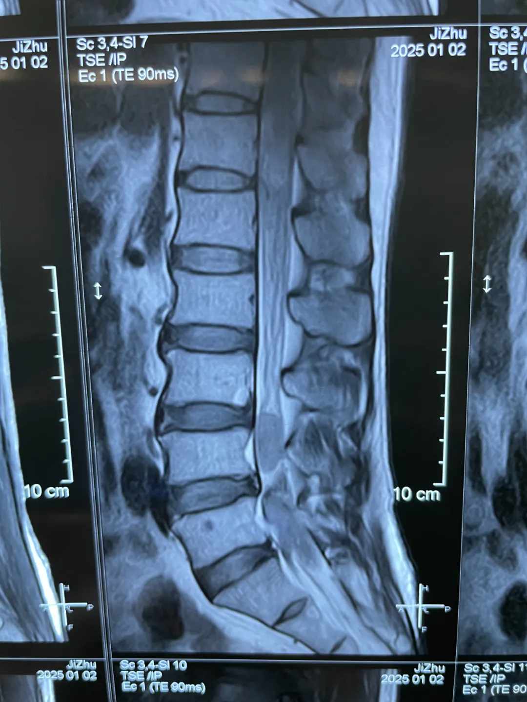 Preoperative Imaging